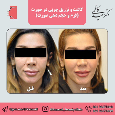زیبایی رویا نیست زیبایی رویا نیست