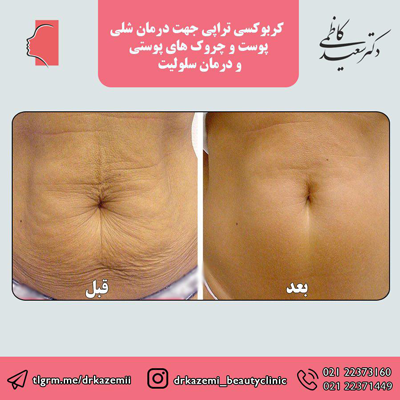 زیبایی رویا نیست زیبایی رویا نیست