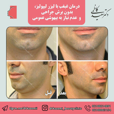 زیبایی رویا نیست زیبایی رویا نیست