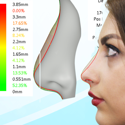 قالب های کنترلی تحولی نوین برای جراحی های زیبایی قالب های کنترلی تحولی نوین برای جراحی های زیبایی