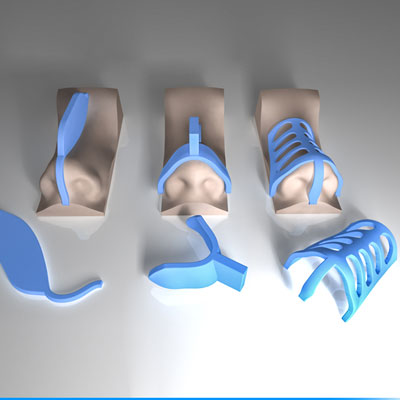 قالب های کنترلی تحولی نوین برای جراحی های زیبایی