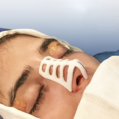 قالب های کنترلی تحولی نوین برای جراحی های زیبایی قالب های کنترلی تحولی نوین برای جراحی های زیبایی