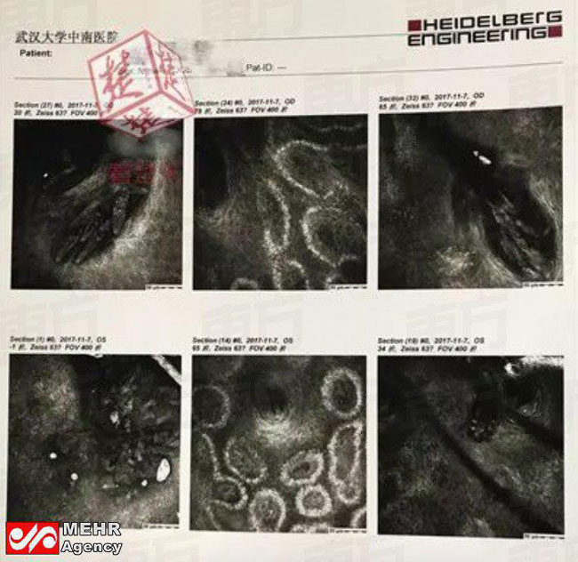 نتیجه ۵ سال نشستن بالشت