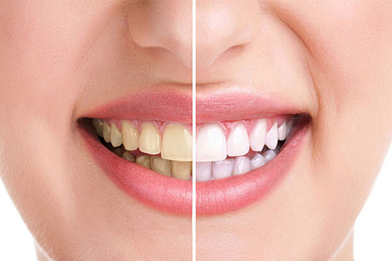 رنگِ رفته دیگه هیچوقت نمیاد؟ رنگِ رفته دیگه هیچوقت نمیاد؟