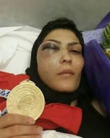 صفر تا سکو؛ خواهرانه ای از جنس عشق، اراده و تلاش صفر تا سکو؛ خواهرانه ای از جنس عشق، اراده و تلاش