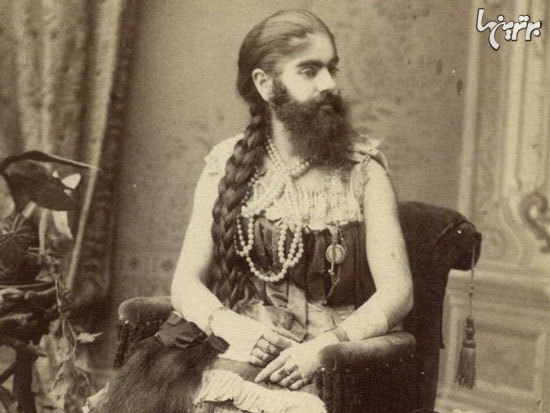 افراد عجیبی که در سیرک بارنوم نمایش دادند