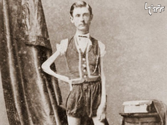 افراد عجیبی که در سیرک بارنوم نمایش دادند