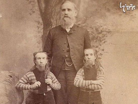 افراد عجیبی که در سیرک بارنوم نمایش دادند