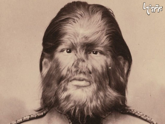 افراد عجیبی که در سیرک بارنوم نمایش دادند