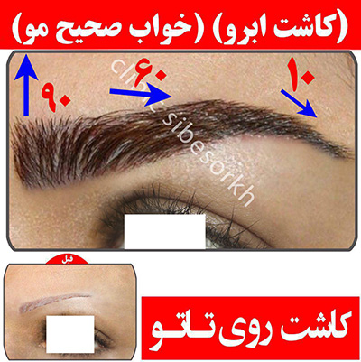 کاشت ابرو با موهای طبیعی