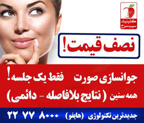 برای اطلاع از قیمت هایفو این مطلب را بخوانید