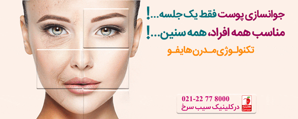 برای اطلاع از قیمت هایفو این مطلب را بخوانید