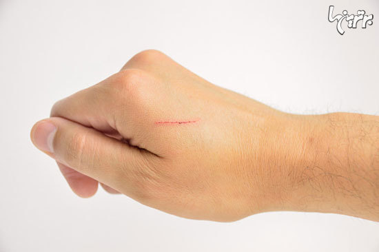 12 اشتباه رایجی که معمولا در انجام کمک های اولیه مرتکب می شویم 12 اشتباه رایجی که معمولا در انجام کمک های اولیه مرتکب می شویم