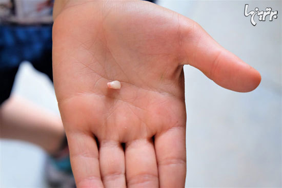 12 اشتباه رایجی که معمولا در انجام کمک های اولیه مرتکب می شویم 12 اشتباه رایجی که معمولا در انجام کمک های اولیه مرتکب می شویم