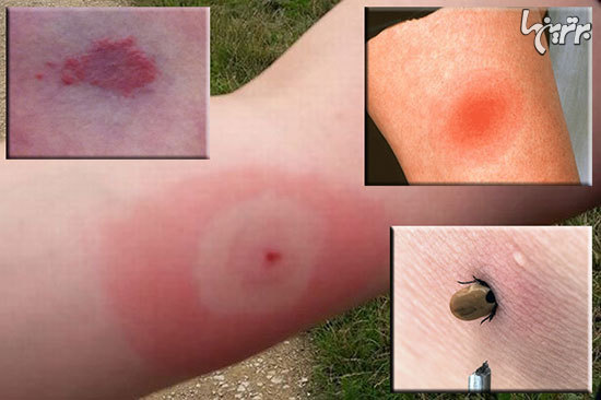 12 اشتباه رایجی که معمولا در انجام کمک های اولیه مرتکب می شویم 12 اشتباه رایجی که معمولا در انجام کمک های اولیه مرتکب می شویم