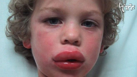 12 اشتباه رایجی که معمولا در انجام کمک های اولیه مرتکب می شویم 12 اشتباه رایجی که معمولا در انجام کمک های اولیه مرتکب می شویم