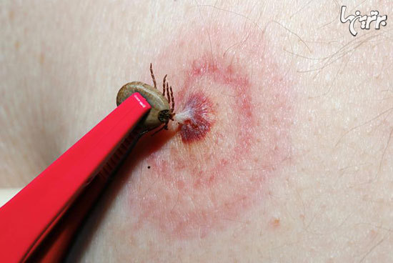 12 اشتباه رایجی که معمولا در انجام کمک های اولیه مرتکب می شویم 12 اشتباه رایجی که معمولا در انجام کمک های اولیه مرتکب می شویم