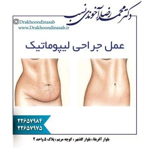 دکتر محمد رضا آخوندی نسب - جراحی پلاستیک و زیبایی