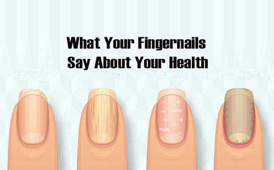 شکل و رنگ ناخن چه اطلاعاتی را در مورد سلامتی شما فاش خواهند کرد؟ شکل و رنگ ناخن چه اطلاعاتی را در مورد سلامتی شما فاش خواهند کرد؟