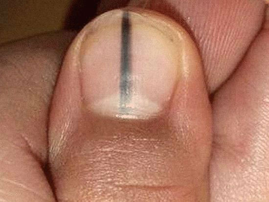 شکل و رنگ ناخن چه اطلاعاتی را در مورد سلامتی شما فاش خواهند کرد؟ شکل و رنگ ناخن چه اطلاعاتی را در مورد سلامتی شما فاش خواهند کرد؟