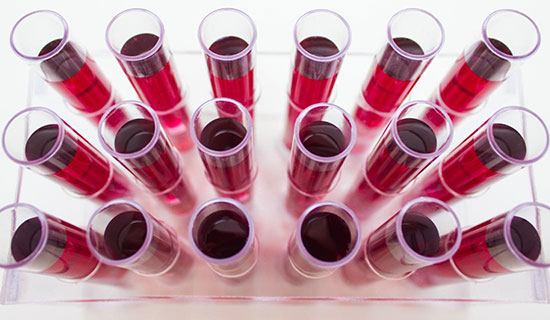 بیماریهای خون ؛ اختلال گلبولهای سفید و قرمز، پلاسما و پلاکت بیماریهای خون ؛ اختلال گلبولهای سفید و قرمز، پلاسما و پلاکت