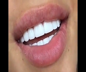 اصلاح طرح لبخند