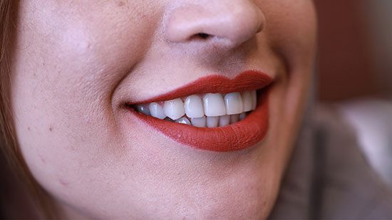 قیمت کامپوزیت دندان