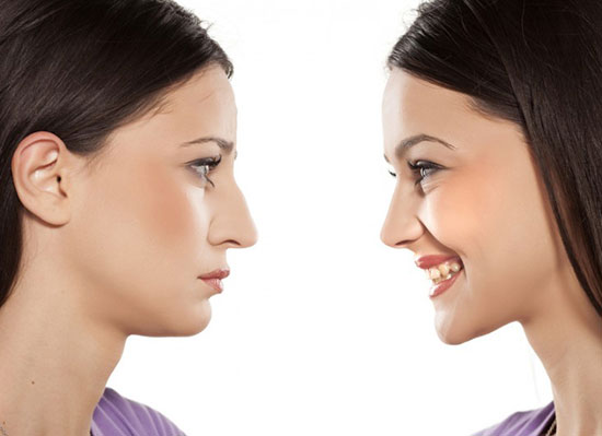 اعتیاد به جراحی های زیبایی، ارثی است!