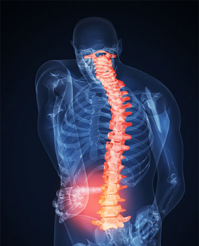 شکستگی‌ها و صدمات اسکلتی بدن