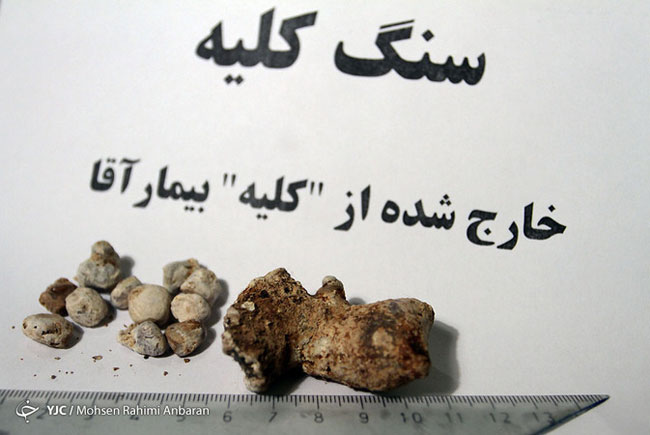 اجسام خارج شده از بدن بیماران در مراکز درمانی - مشهد اجسام خارج شده از بدن بیماران در مراکز درمانی - مشهد