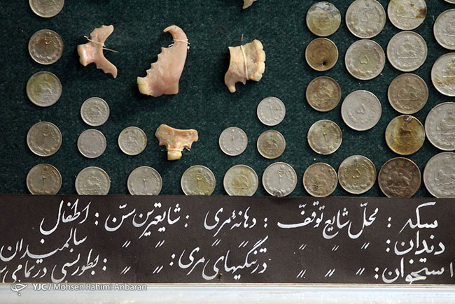 اجسام خارج شده از بدن بیماران در مراکز درمانی - مشهد اجسام خارج شده از بدن بیماران در مراکز درمانی - مشهد