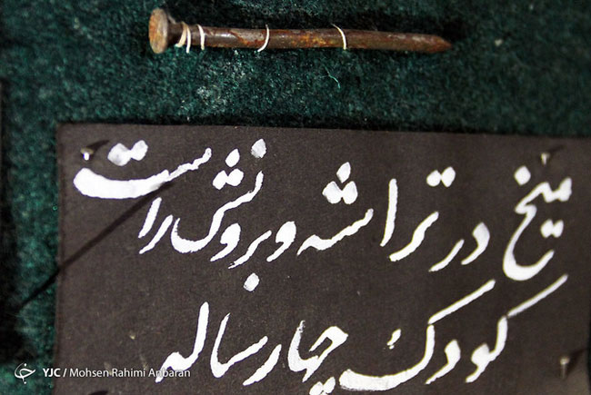 اجسام خارج شده از بدن بیماران در مراکز درمانی - مشهد اجسام خارج شده از بدن بیماران در مراکز درمانی - مشهد