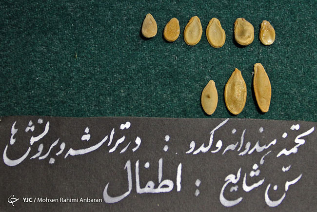 اجسام خارج شده از بدن بیماران در مراکز درمانی - مشهد اجسام خارج شده از بدن بیماران در مراکز درمانی - مشهد