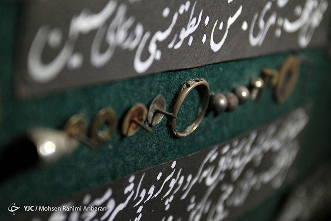 اجسام خارج شده از بدن بیماران در مراکز درمانی - مشهد اجسام خارج شده از بدن بیماران در مراکز درمانی - مشهد