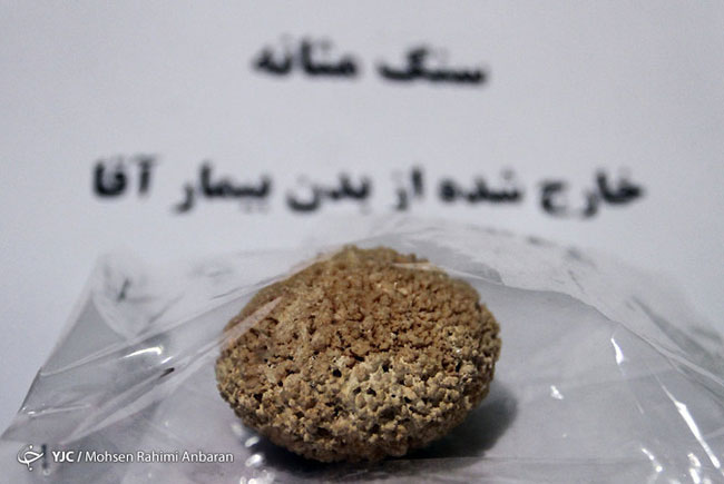 اجسام خارج شده از بدن بیماران در مراکز درمانی - مشهد اجسام خارج شده از بدن بیماران در مراکز درمانی - مشهد