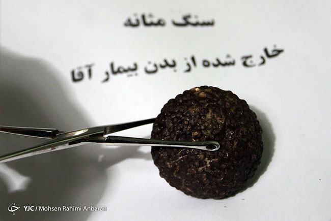 اجسام خارج شده از بدن بیماران در مراکز درمانی - مشهد اجسام خارج شده از بدن بیماران در مراکز درمانی - مشهد