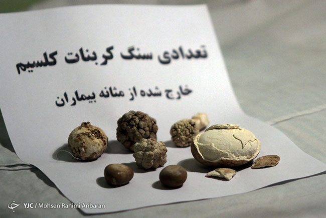 اجسام خارج شده از بدن بیماران در مراکز درمانی - مشهد اجسام خارج شده از بدن بیماران در مراکز درمانی - مشهد