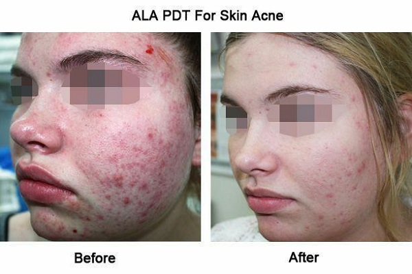 کلینیک زیبایی پوست و مو - دکتر افسانه زرگنج فرد کلینیک زیبایی پوست و مو - دکتر افسانه زرگنج فرد