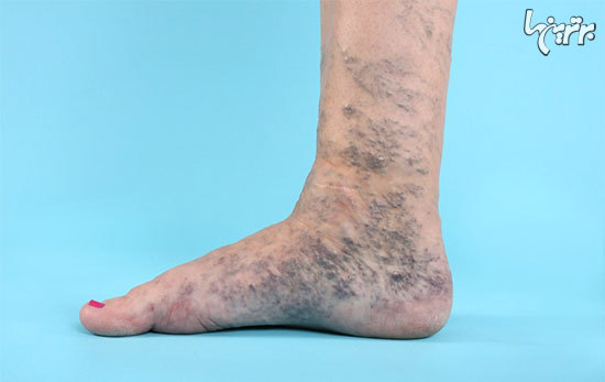 کلینیک واریس دکتر بهزاد جزایری کلینیک واریس دکتر بهزاد جزایری