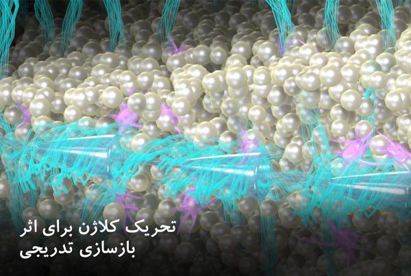 روشهای جوانسازی پوست؛ از لایه برداری تا هایفوتراپی روشهای جوانسازی پوست؛ از لایه برداری تا هایفوتراپی