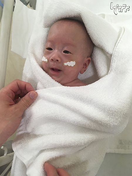 کوچکترین نوزاد نارس جهان بالاخره از بیمارستان مرخص شد