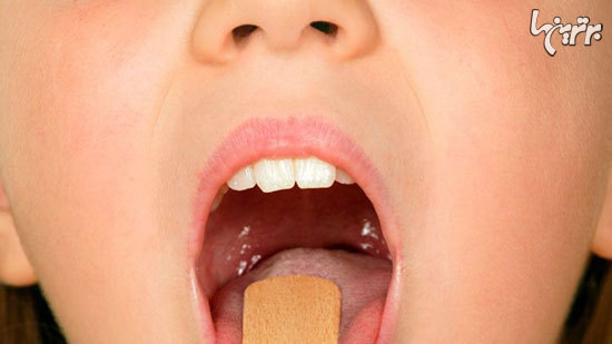 سنگ لوزه؛ راه‌های پیشگیری و درمان خانگی