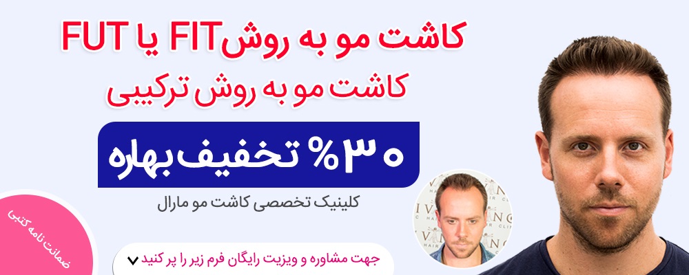 هزینه کاشت مو