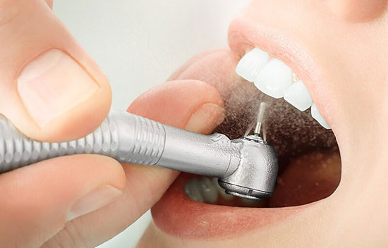 اگر کرم خوردگی دندان را جدی نگیرید چه می‌شود؟