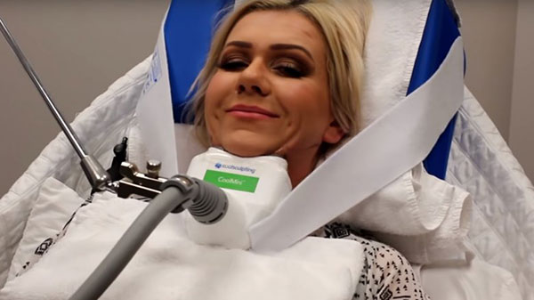 لاغری به روش مجسمه‌سازی سرد؛ واقعیاتی در مورد روش CoolSculpting یا کرایو لیپولیز