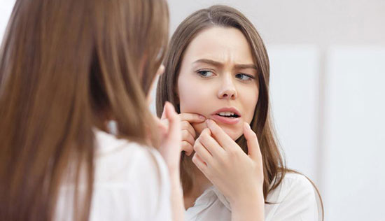 چه‌کار کنیم که جوش نزنیم؟