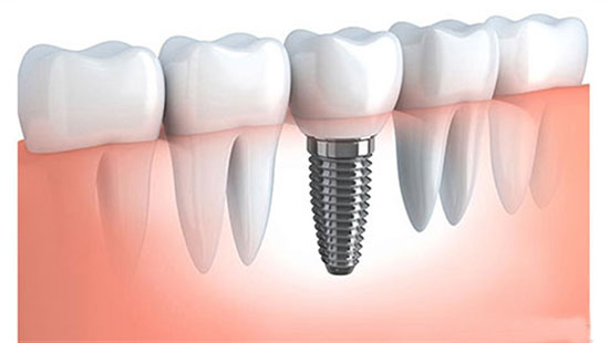 پیشگیری از بیماریها با لیزر پیشگیری از بیماریها با لیزر