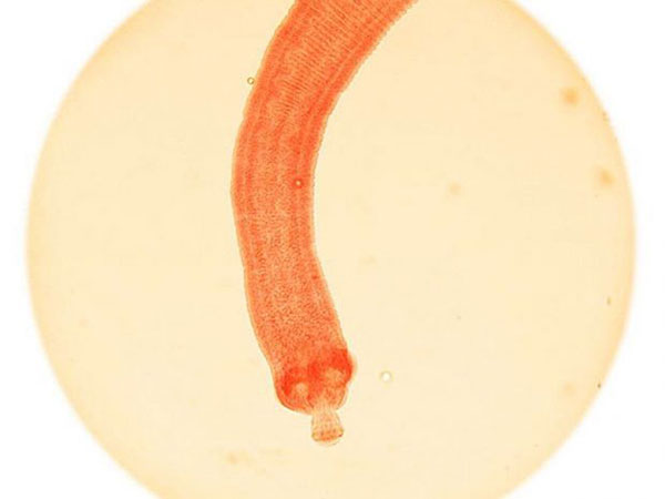 با مرگبارترین موجودات کره زمین آشنا شوید با مرگبارترین موجودات کره زمین آشنا شوید