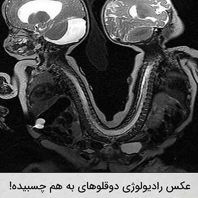 عکس‌هایی که ارزش دارند!