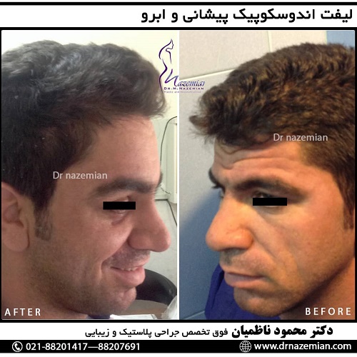 دکتر محمود ناظمیان – فوق تخصص جراحی پلاستیک و زیبایی دکتر محمود ناظمیان – فوق تخصص جراحی پلاستیک و زیبایی